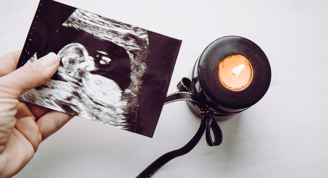 A lit candle beside an ultrasound picture